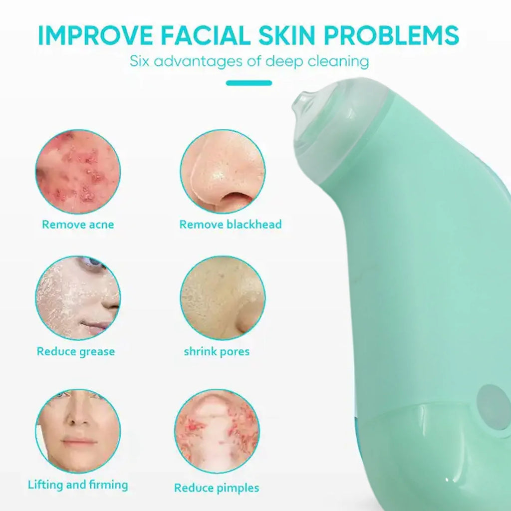 Mini Handheld Vacuum Blackhead Remover – Facial Massage & Spot Lifter